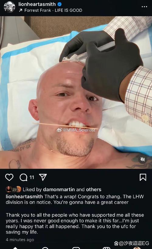 WWE量级的训练？队内训练后普理查德脖子破洞流血 血疤蔓延至胸口